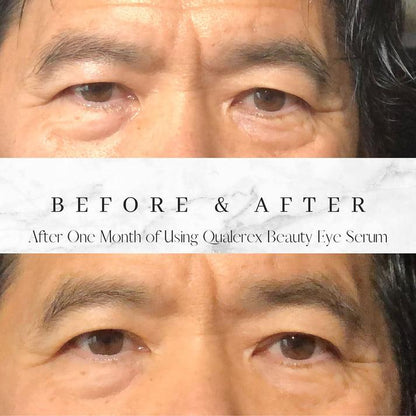 Qualerex Beauty Eye Serum with Green Caviar • Deep nourishment. Radiant eyes. Timeless beauty